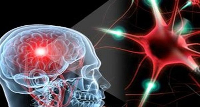 Παγκόσμια Ημέρα Σκλήρυνσης κατά Πλάκας, 30η Μαΐου και Φωτισμός Δημαρχείων Ηπείρου και όλης της χώρας με χρώμα πορτοκαλί