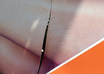 Καταγγελία για Βανδαλισμό Καλλιτεχνικών Έργων στον περιβάλλοντα χώρο του δημαρχείου Ιωαννίνων