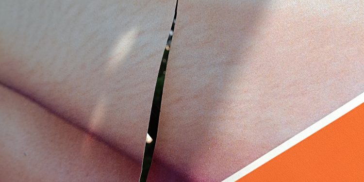 Καταγγελία για Βανδαλισμό Καλλιτεχνικών Έργων στον περιβάλλοντα χώρο του δημαρχείου Ιωαννίνων